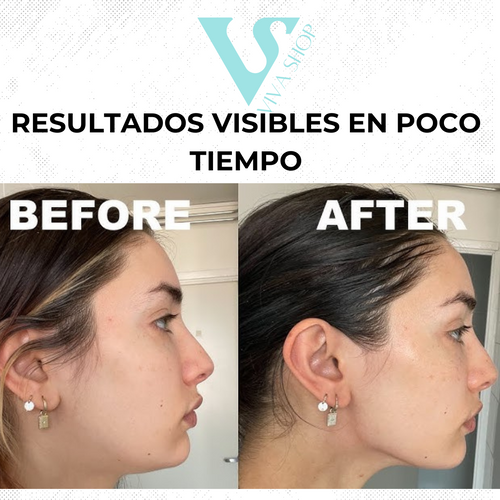 Masajeador Facial